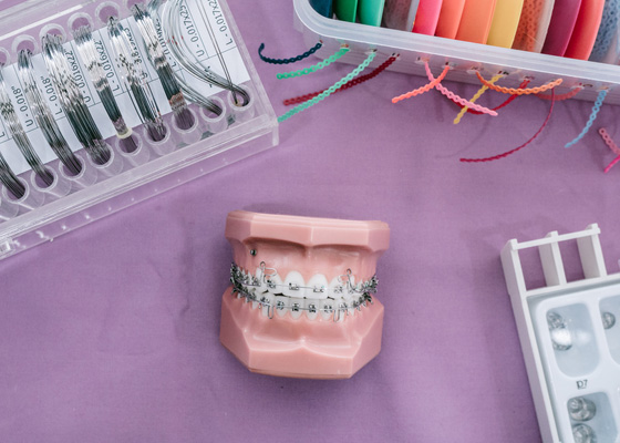 Fake teeth to illustrate braces procedure