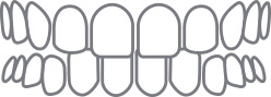 Illustration of teeth spacing issues