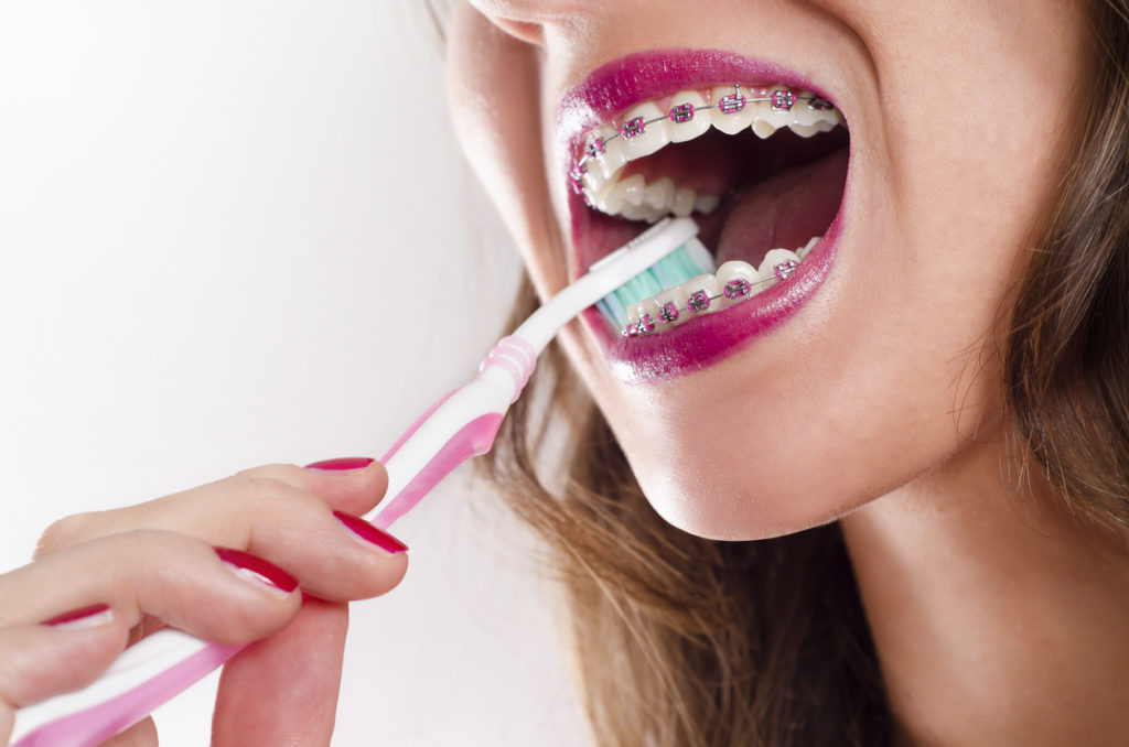 Woman brushing her teeth with braces